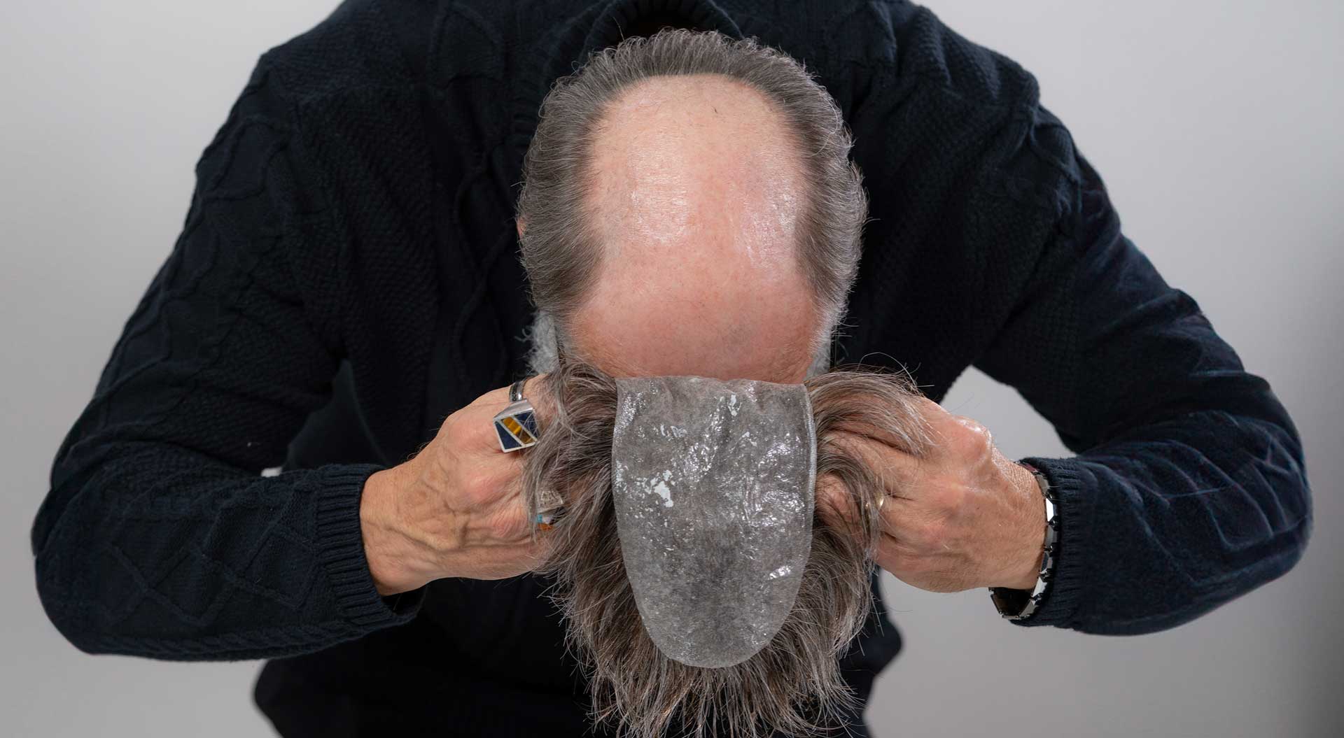 Installeer het haar systeem​