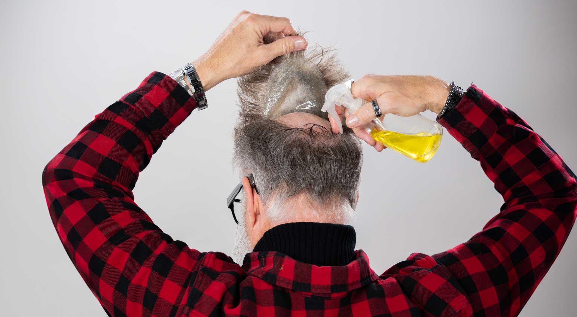 Het verwijderen van het haar systeem​