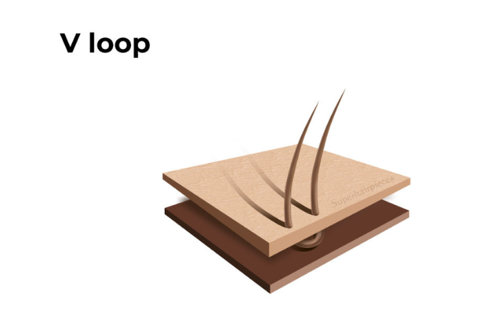v-loop
